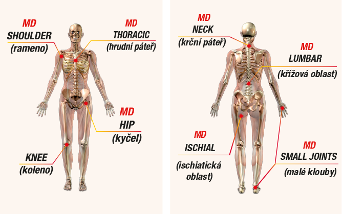 Sinonim arthrosilen